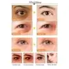 Dr.Rashel 24k Gold Collagen Hydro gel Eye Mask