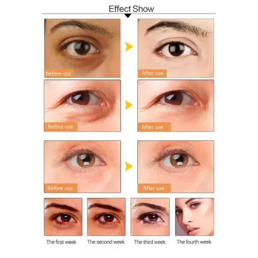 Dr.Rashel 24k Gold Collagen Hydro gel Eye Mask